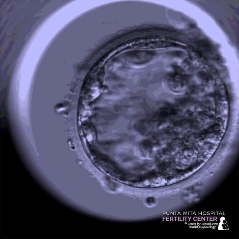 Embryo Biopsy: Detecting Genetic Diseases Detection and Selecting Gender