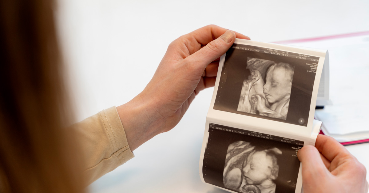 PGT-A fertility testing